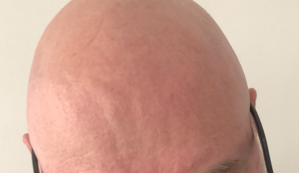 What shaving my head can teach you about content marketing for personal branding purposes